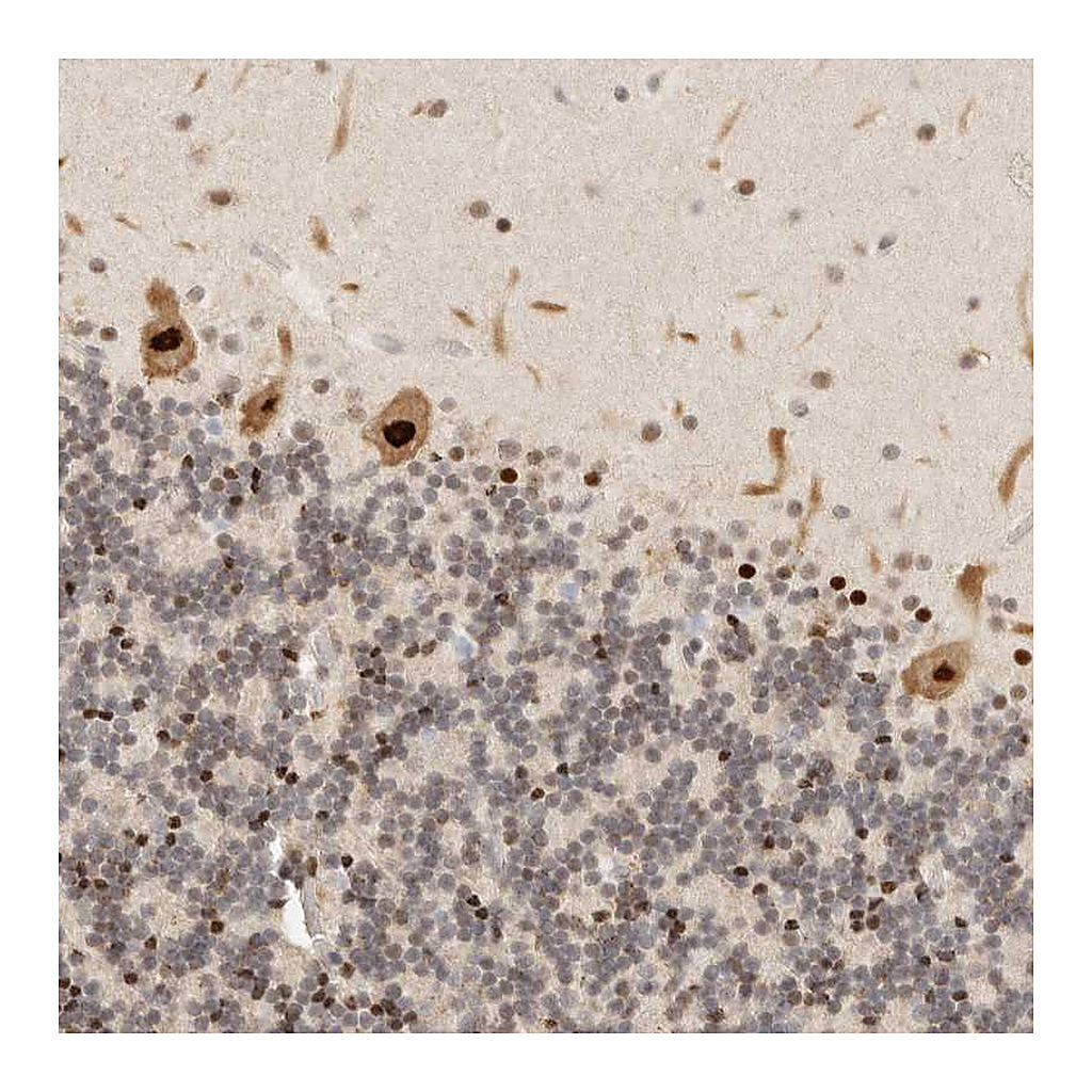Atlas Antibodies Anti-GPBP1L1 Antibody