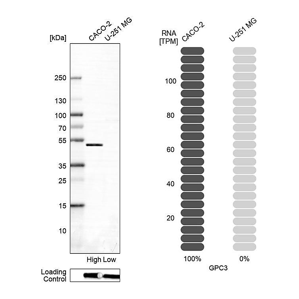 Atlas Antibodies Anti-GPC3 Antibody