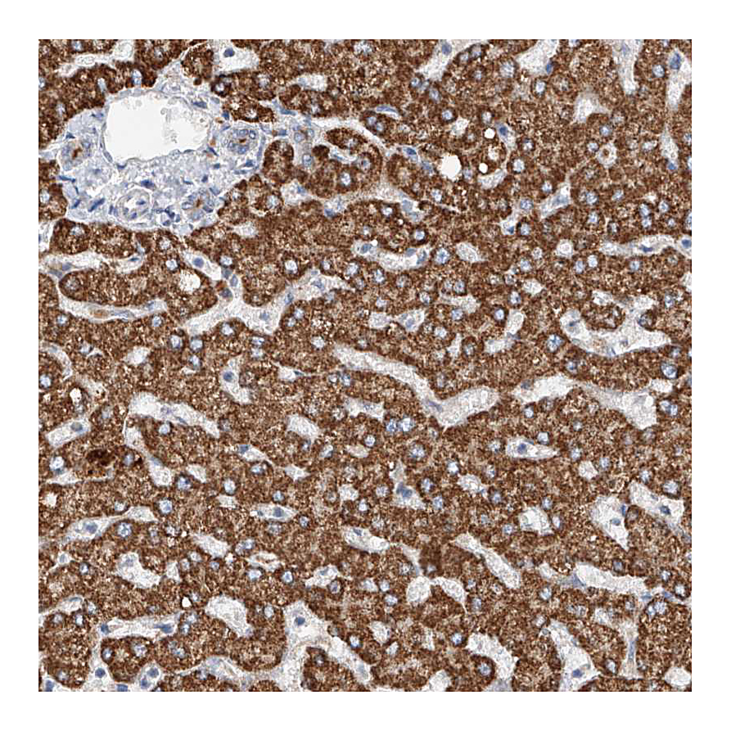 Atlas Antibodies Anti-GPC4 Antibody