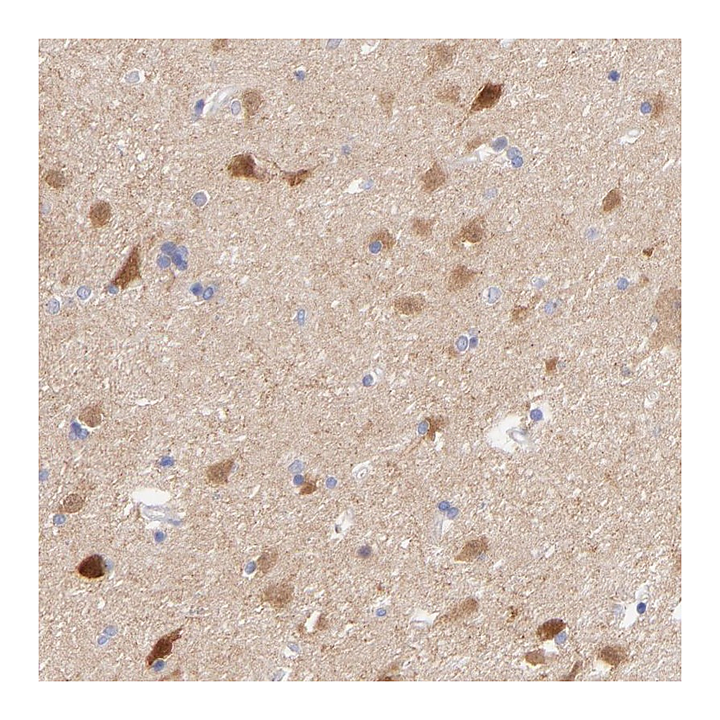 Atlas Antibodies Anti-GPHN Antibody