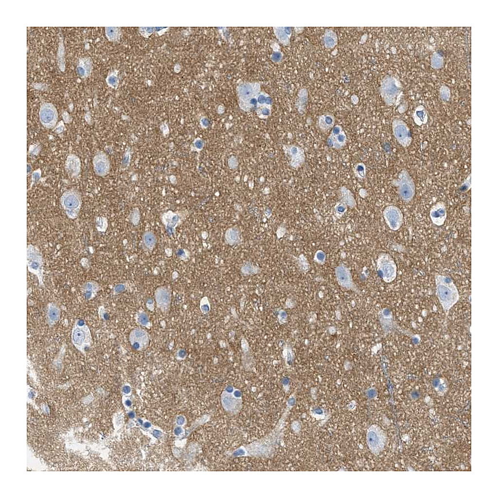 Atlas Antibodies Anti-GPM6A Antibody