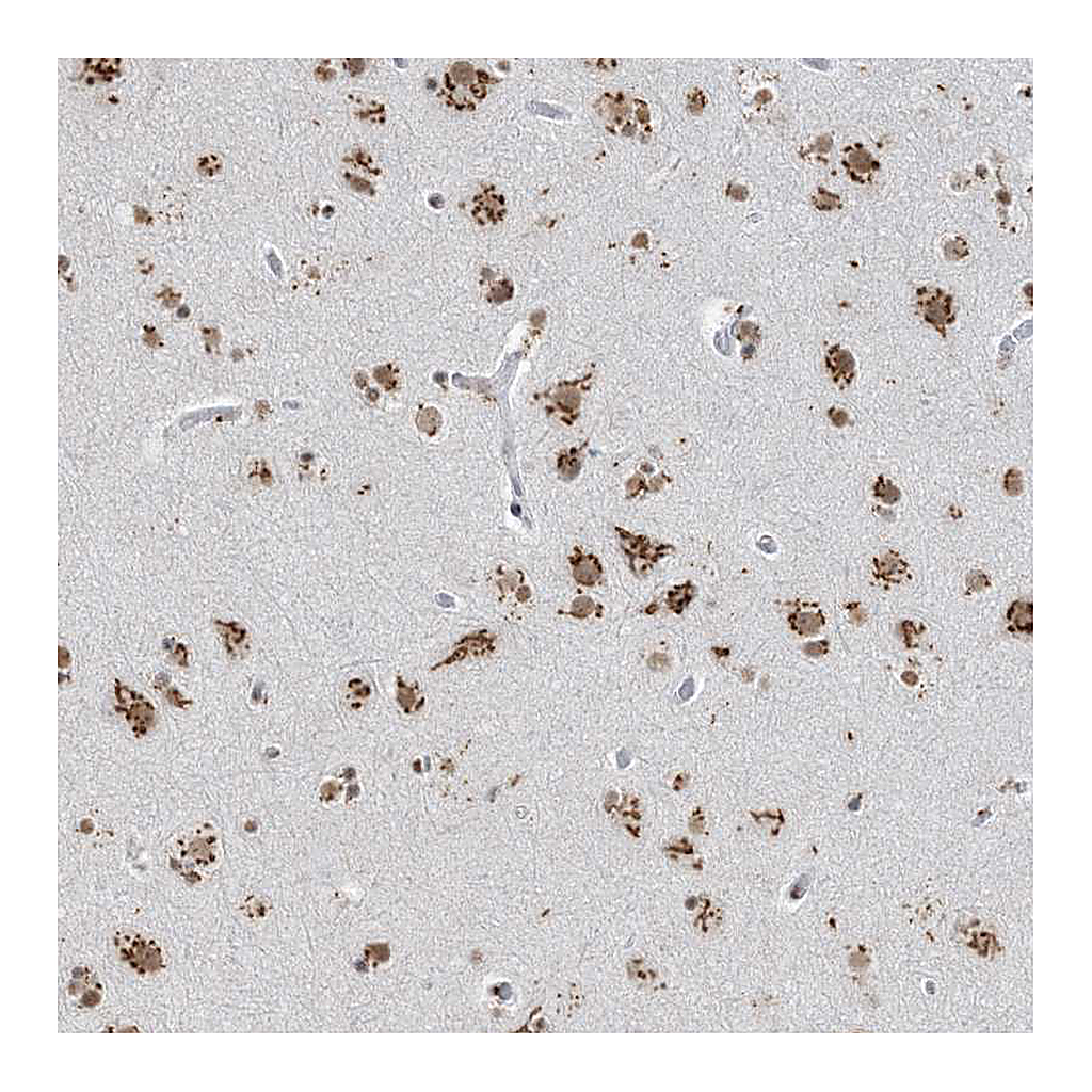 Atlas Antibodies Anti-GPR107 Antibody