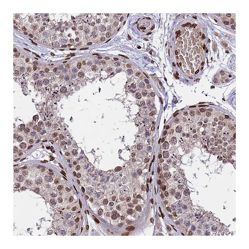 Atlas Antibodies Anti-GPR135 Antibody