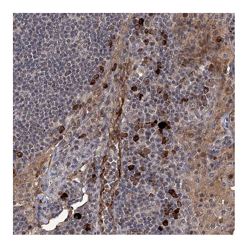 Atlas Antibodies Anti-GPR132 Antibody