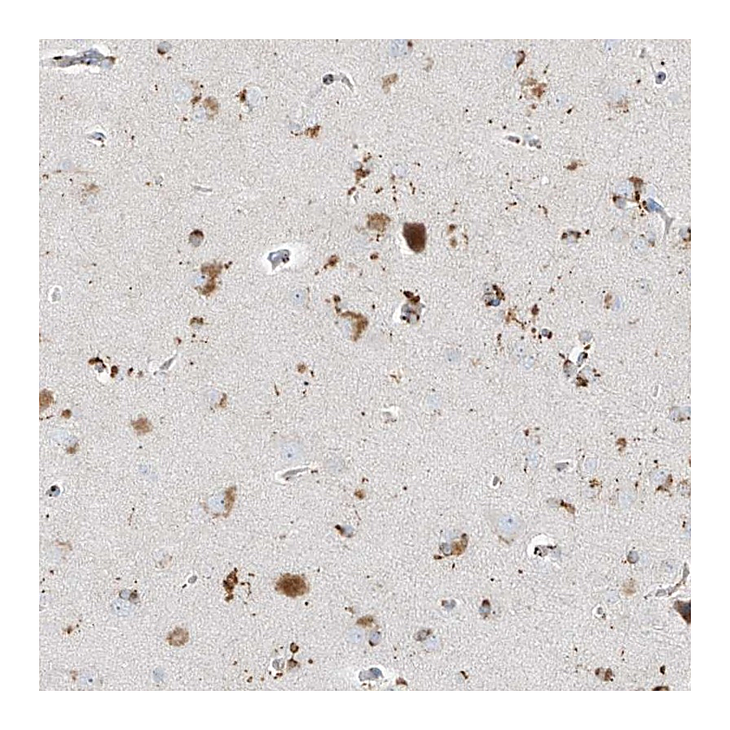 Atlas Antibodies Anti-GPR137C Antibody