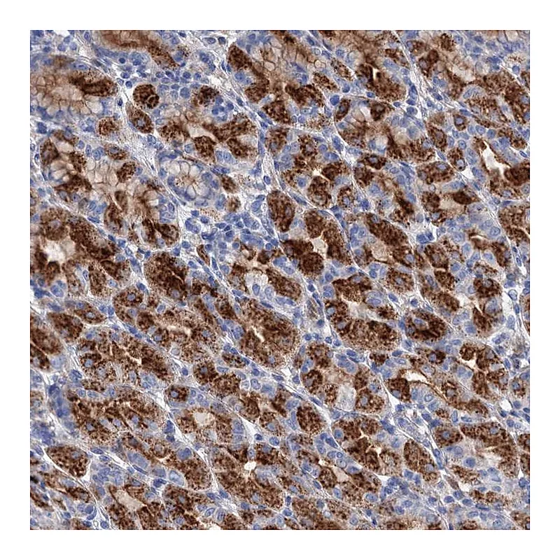 Atlas Antibodies Anti-GPR155 Antibody