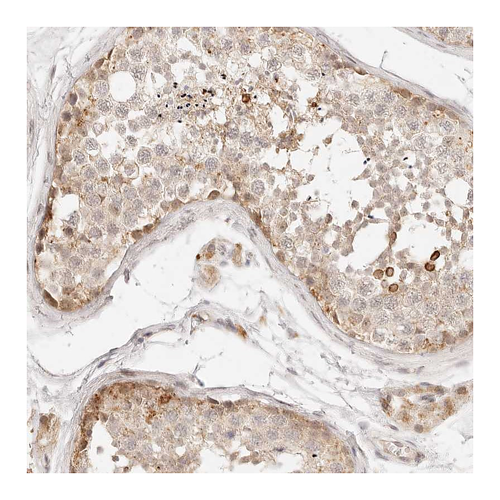Atlas Antibodies Anti-GPR156 Antibody