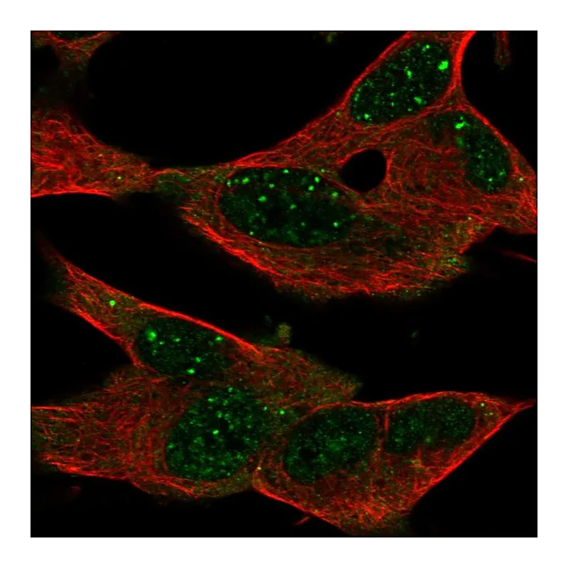 Atlas Antibodies Anti-GPR155 Antibody
