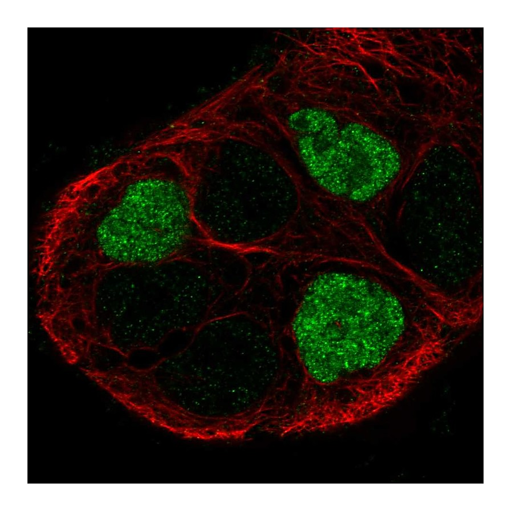 Atlas Antibodies Anti-GPR161 Antibody
