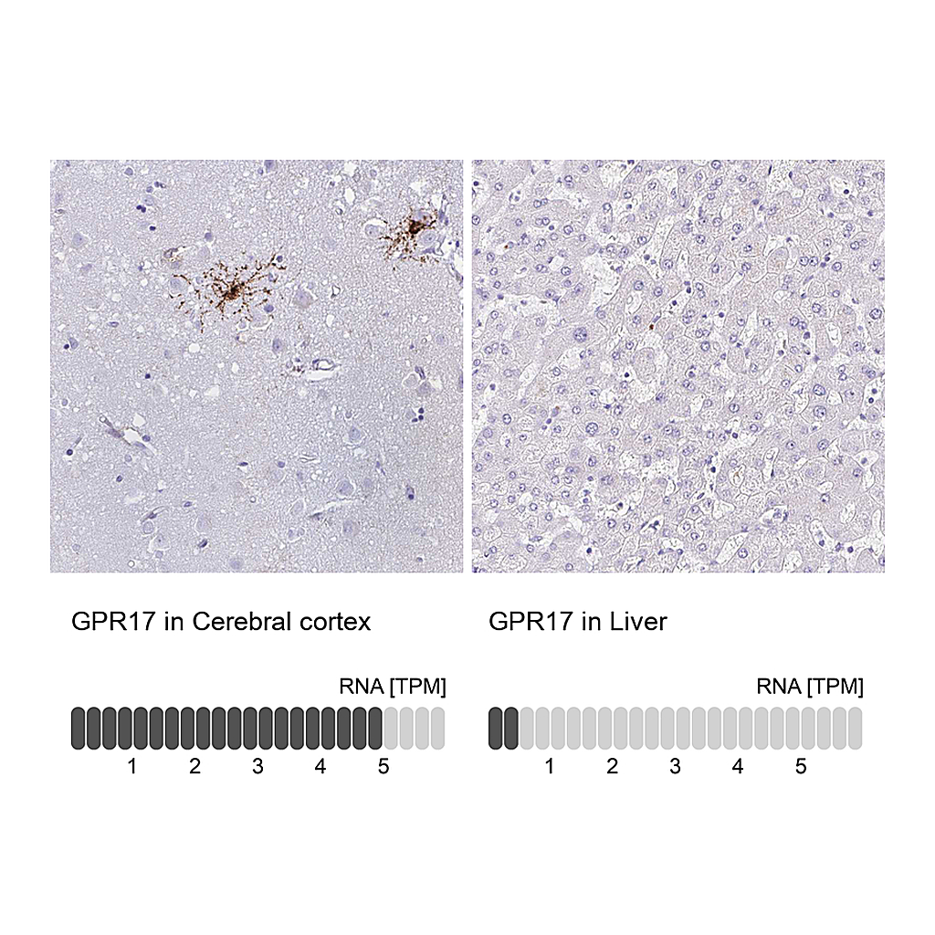 Atlas Antibodies Anti-GPR17 Antibody