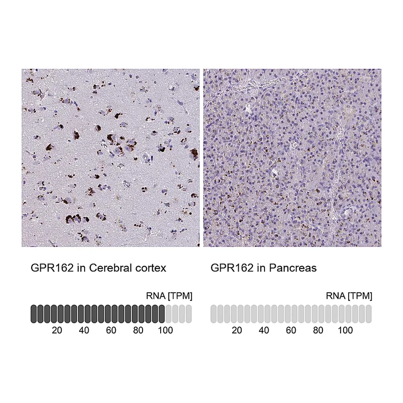 Atlas Antibodies Anti-GPR162 Antibody