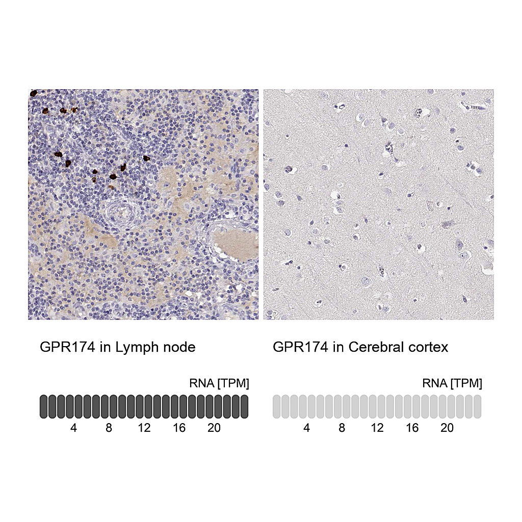 Atlas Antibodies Anti-GPR174 Antibody