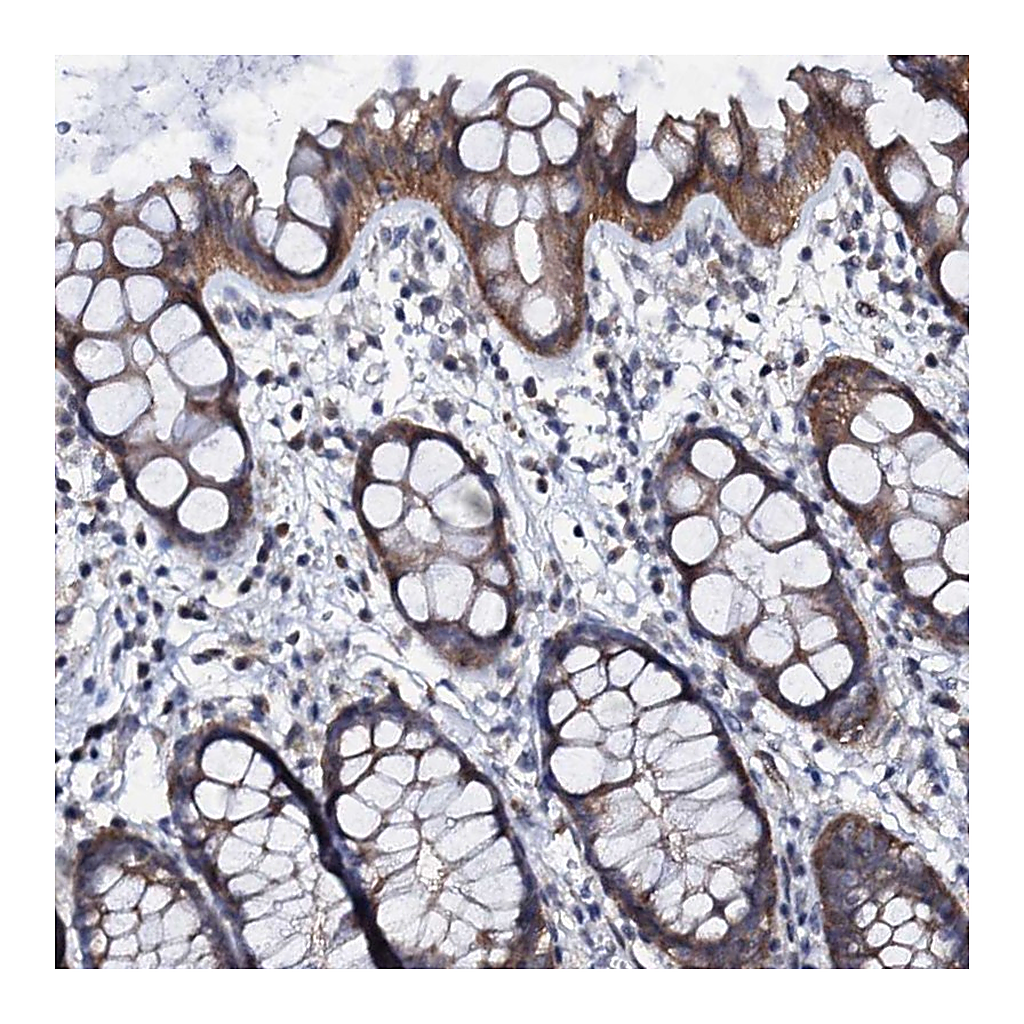 Atlas Antibodies Anti-GPR176 Antibody