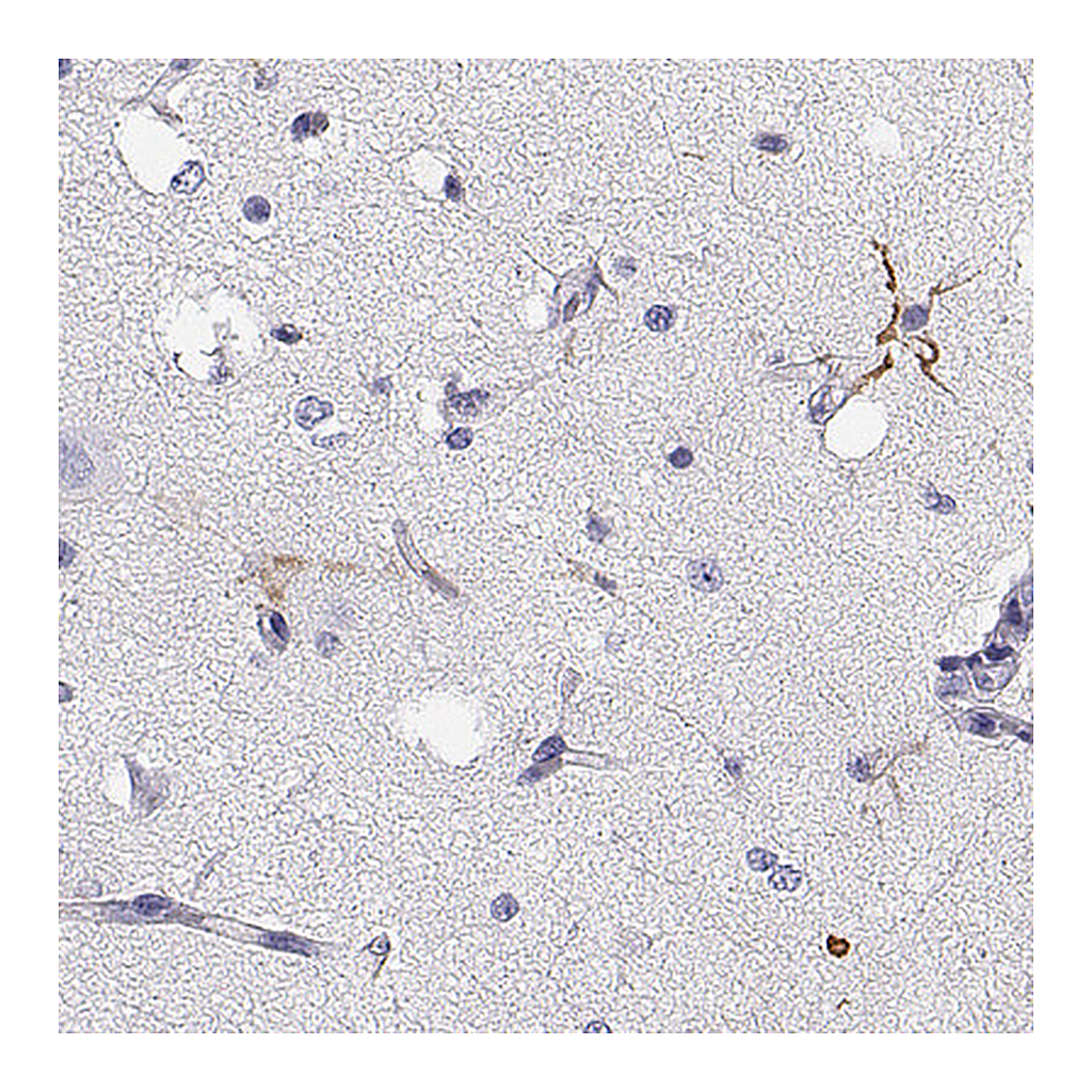 Atlas Antibodies Anti-GPR26 Antibody