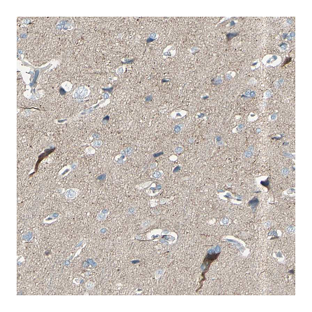 Atlas Antibodies Anti-GPR34 Antibody