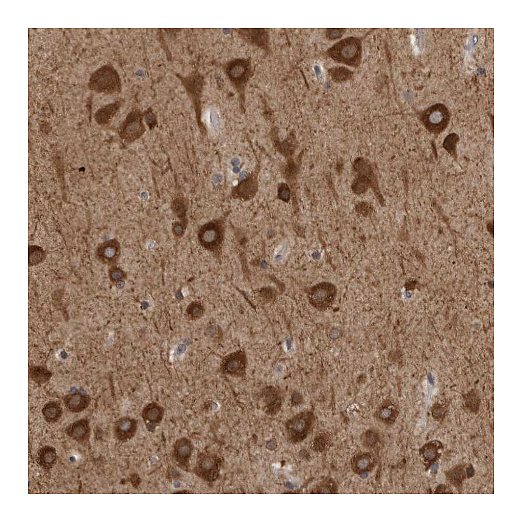 Atlas Antibodies Anti-GPR61 Antibody
