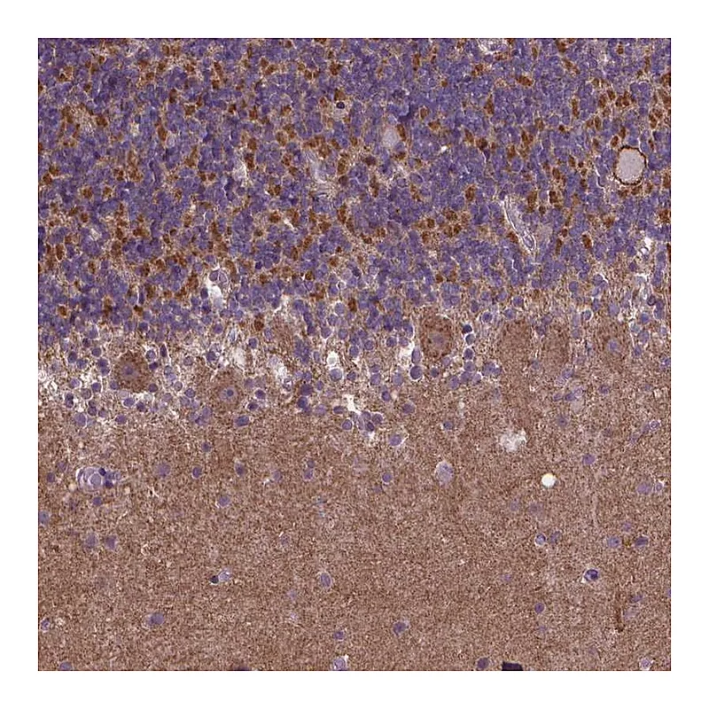 Atlas Antibodies Anti-GPR63 Antibody