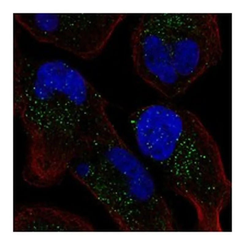 Atlas Antibodies Anti-GPR65 Antibody