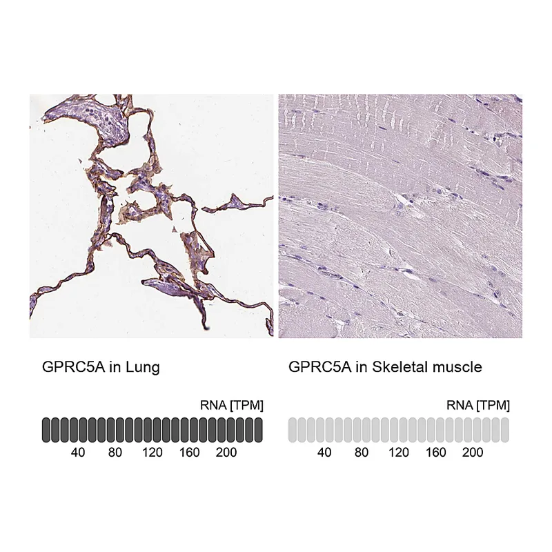 Atlas Antibodies Anti-GPRC5A Antibody