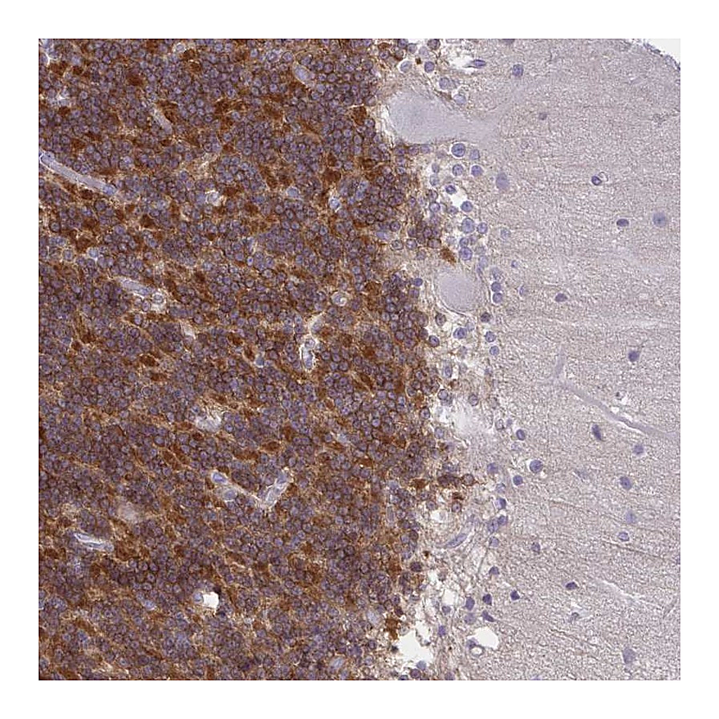 Atlas Antibodies Anti-GPRIN3 Antibody