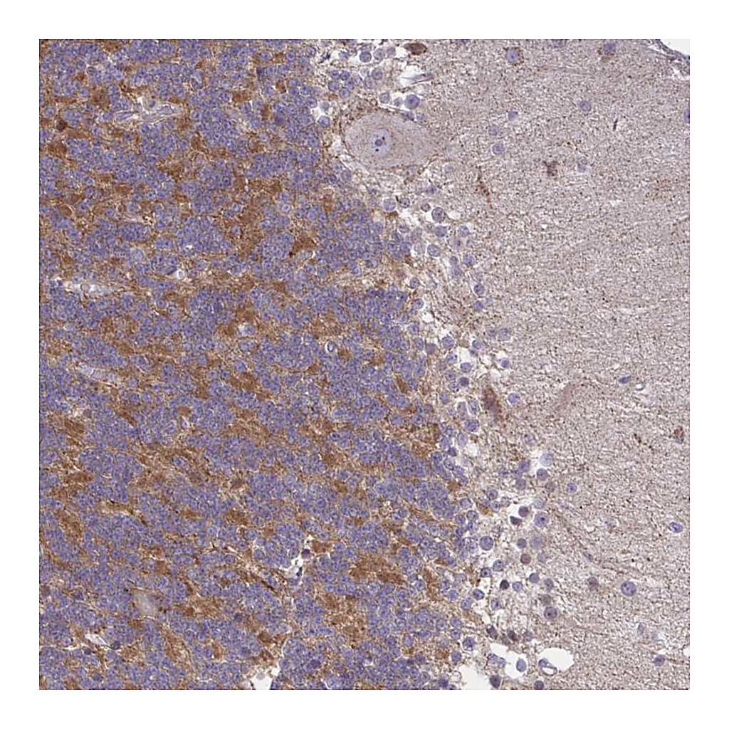 Atlas Antibodies Anti-GPRIN3 Antibody