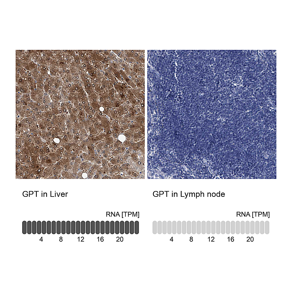 Atlas Antibodies Anti-GPT Antibody