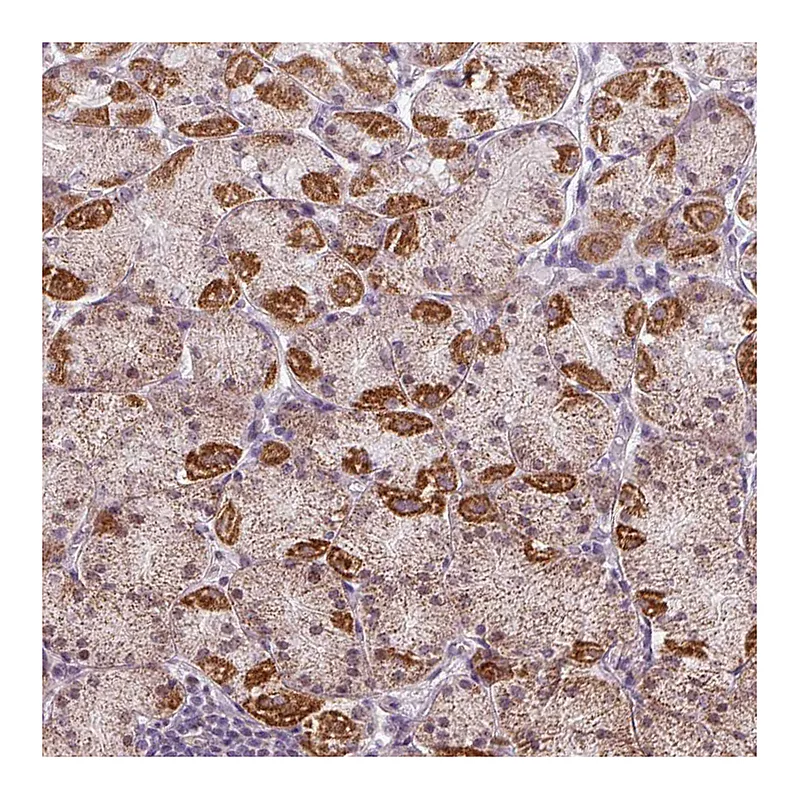 Atlas Antibodies Anti-GPT2 Antibody
