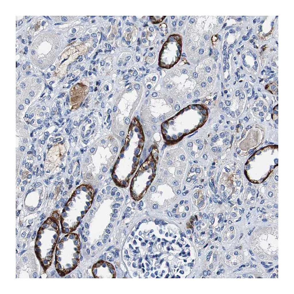 Atlas Antibodies Anti-GRAMD1A Antibody