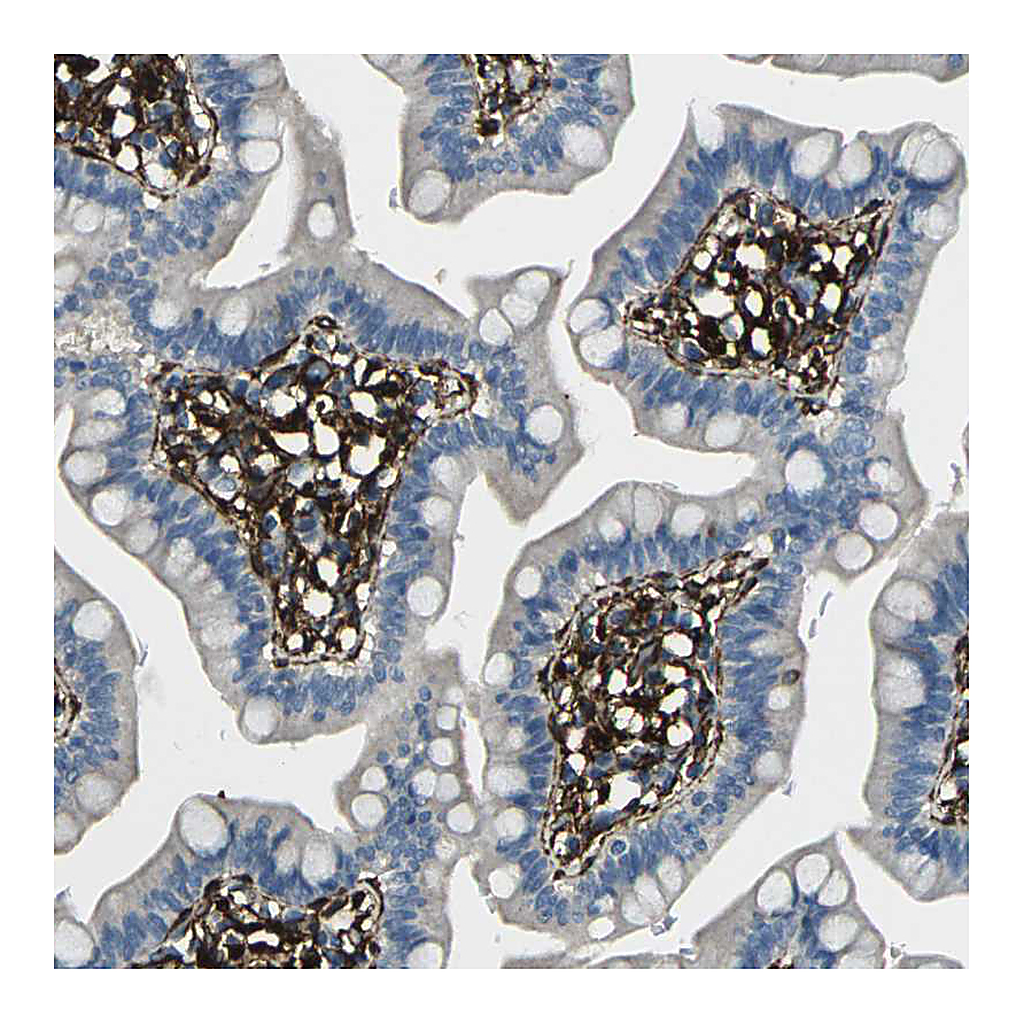 Atlas Antibodies Anti-GRAMD1C Antibody