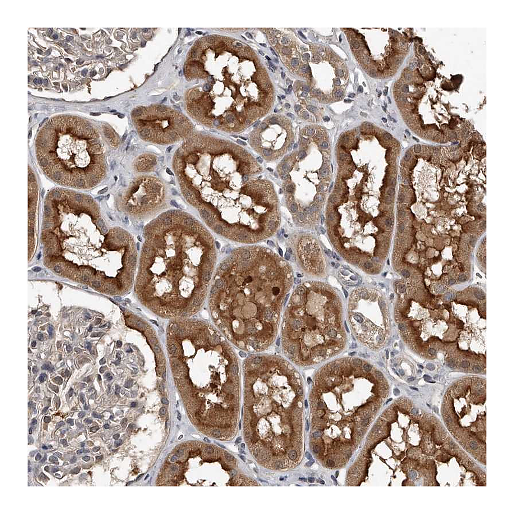 Atlas Antibodies Anti-GRB10 Antibody