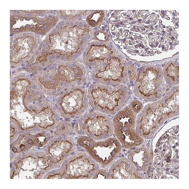 Atlas Antibodies Anti-GRB14 Antibody