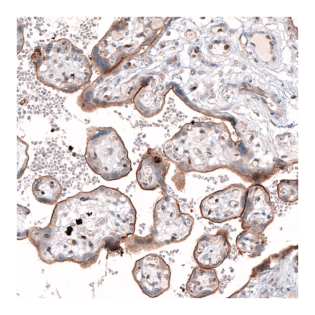 Atlas Antibodies Anti-TSPAN13 Antibody