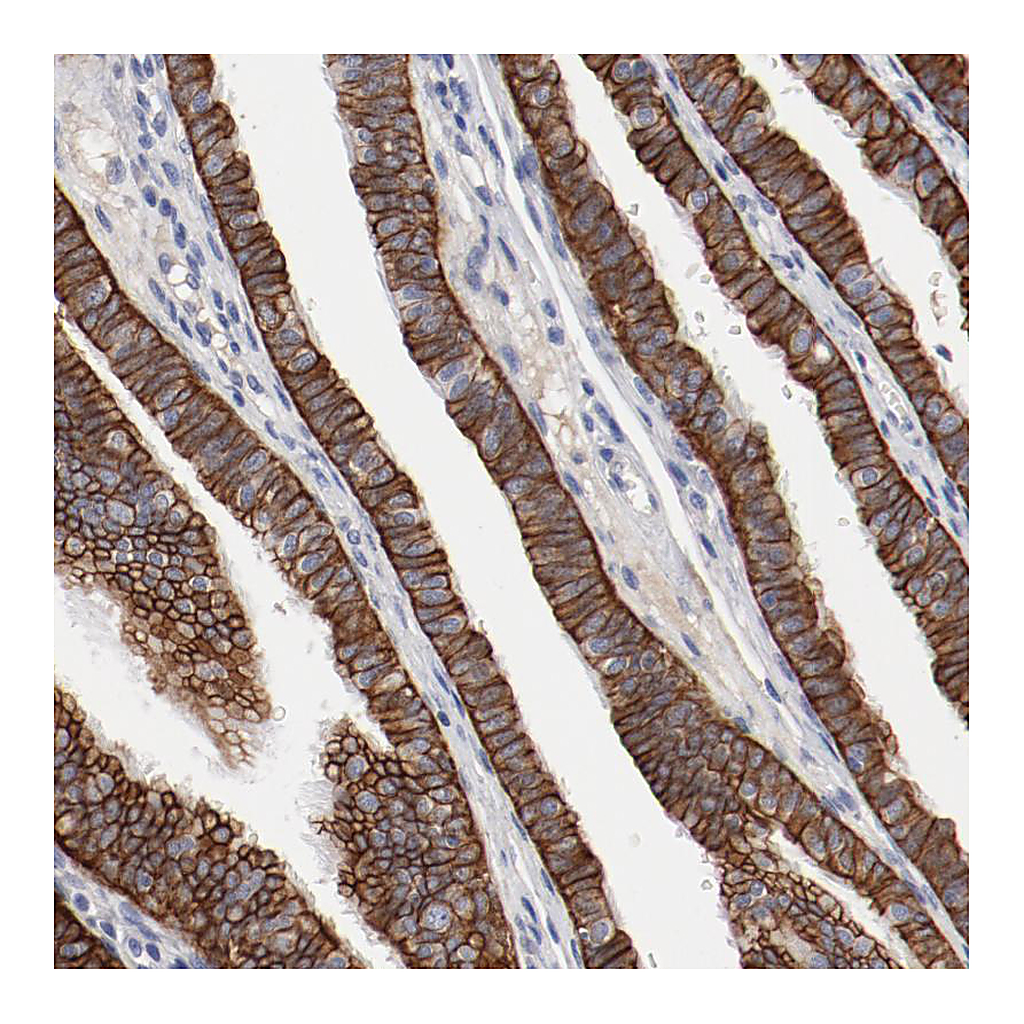 Atlas Antibodies Anti-TSPAN6 Antibody