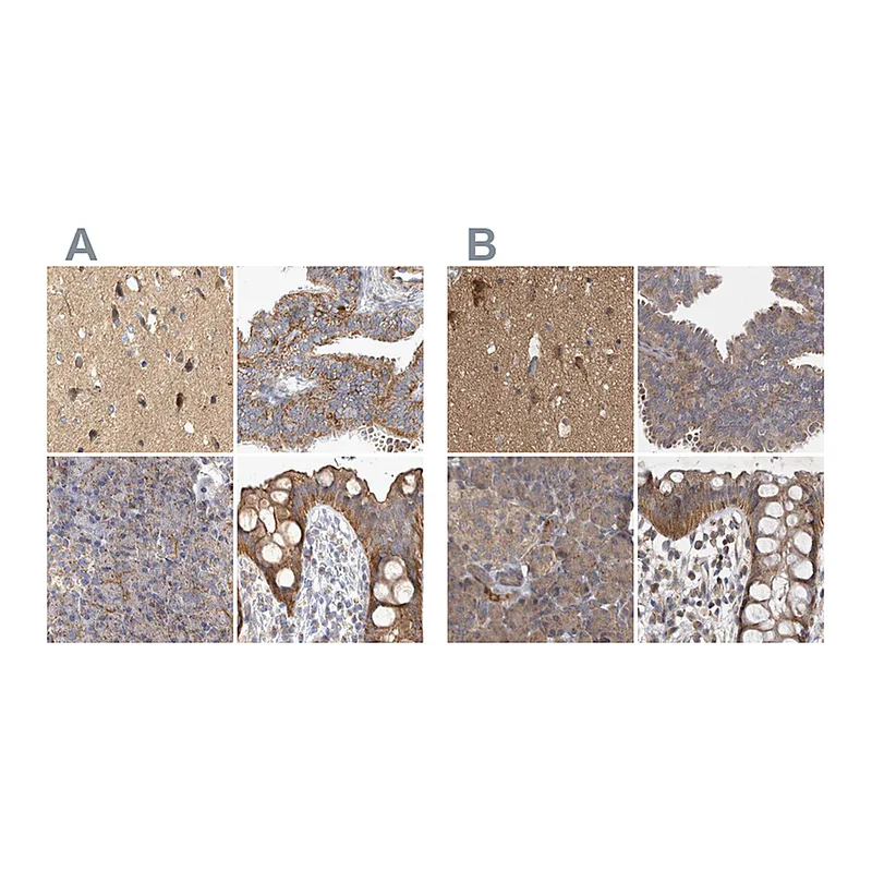 Atlas Antibodies Anti-TSPOAP1 Antibody