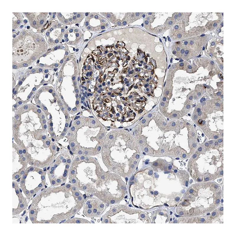 Atlas Antibodies Anti-TSPAN33 Antibody