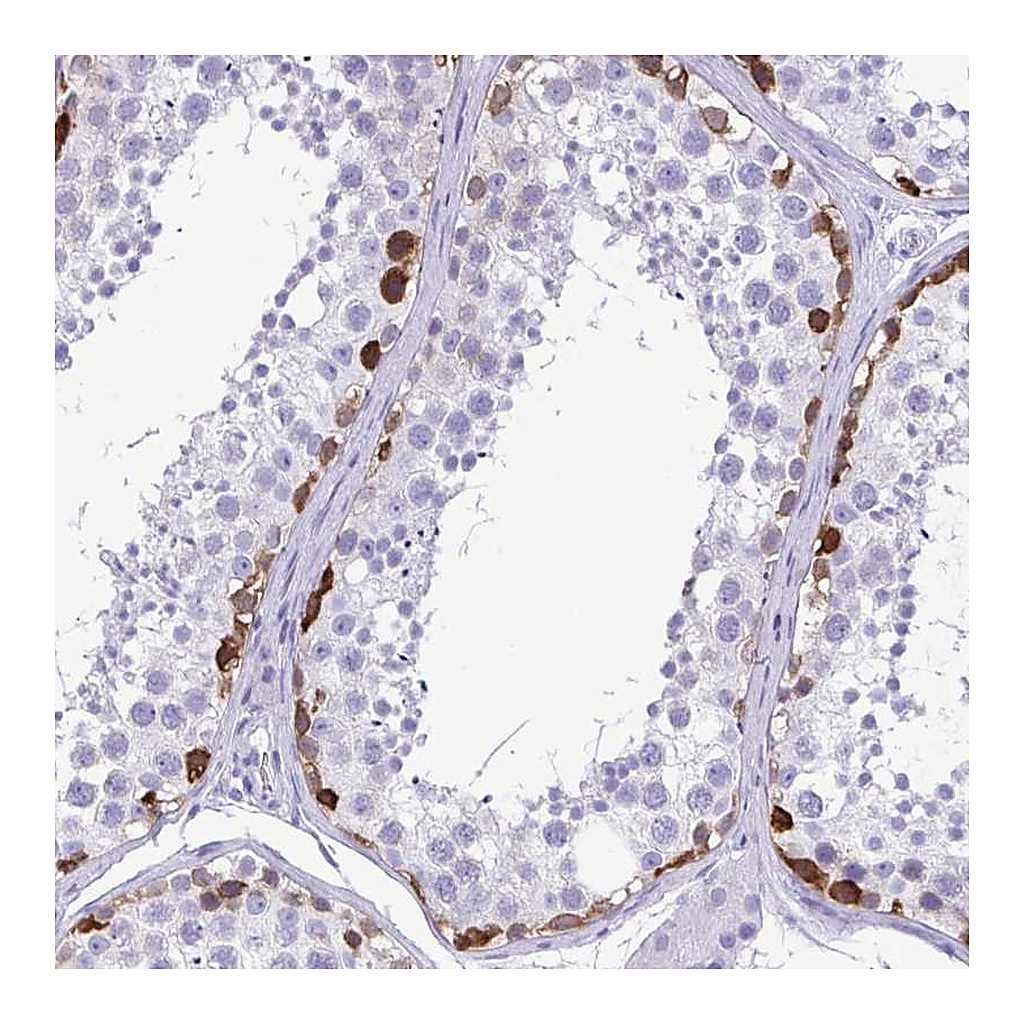 Atlas Antibodies Anti-TSPY4 Antibody
