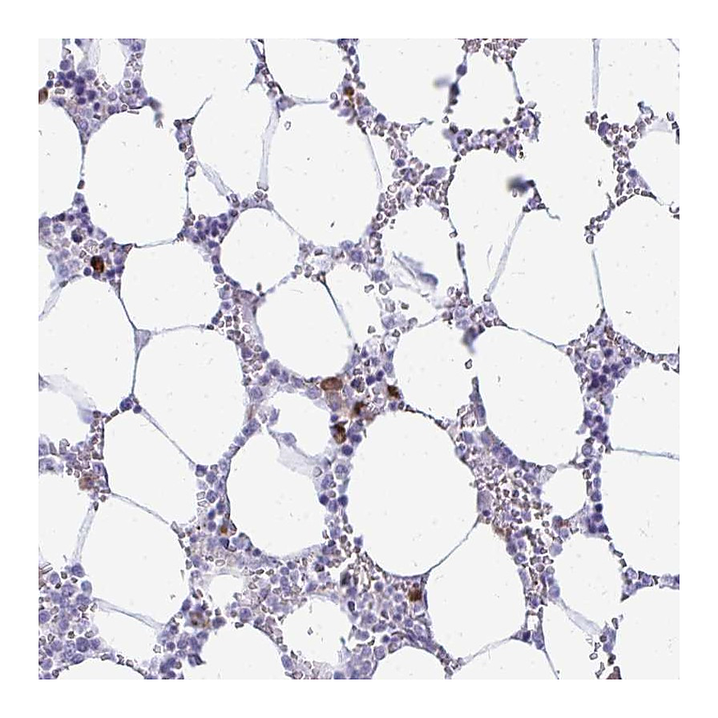 Atlas Antibodies Anti-TSPEAR Antibody