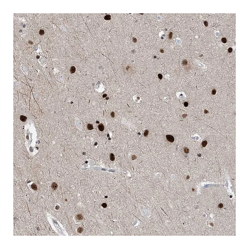 Atlas Antibodies Anti-TSPYL1 Antibody