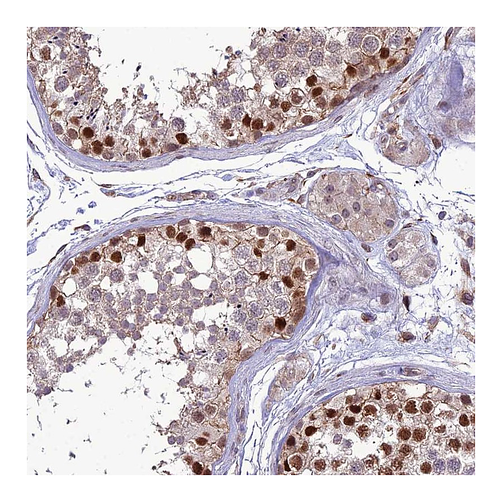 Atlas Antibodies Anti-TSPYL2 Antibody