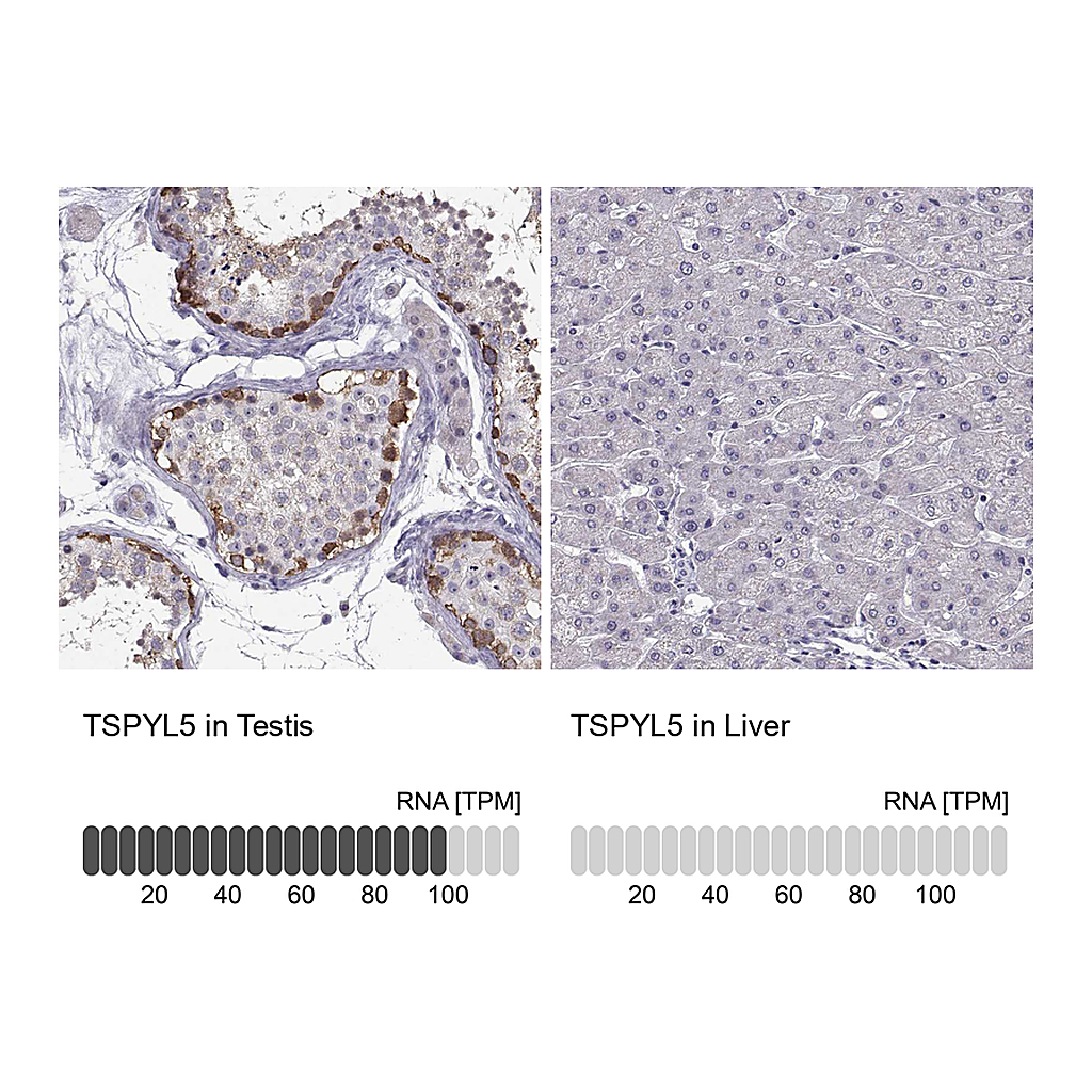Atlas Antibodies Anti-TSPYL5 Antibody