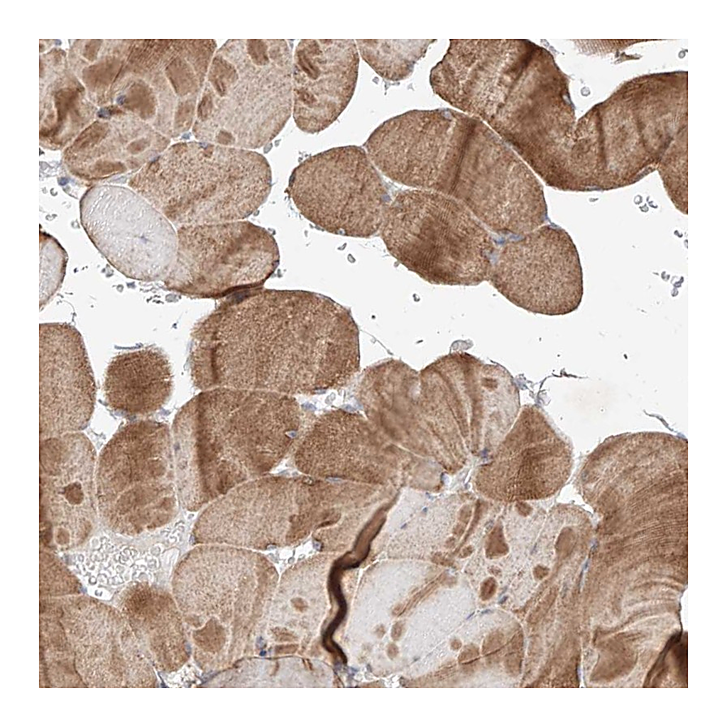 Atlas Antibodies Anti-TSR2 Antibody