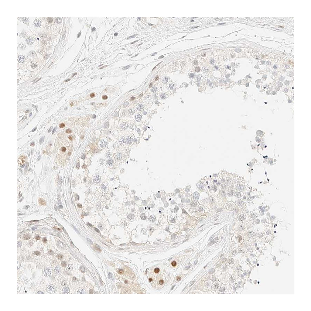 Atlas Antibodies Anti-TSR1 Antibody