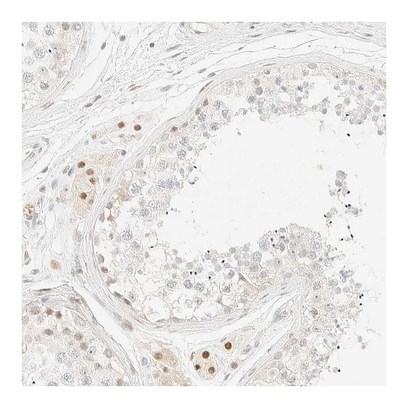 Atlas Antibodies Anti-TSR1 Antibody
