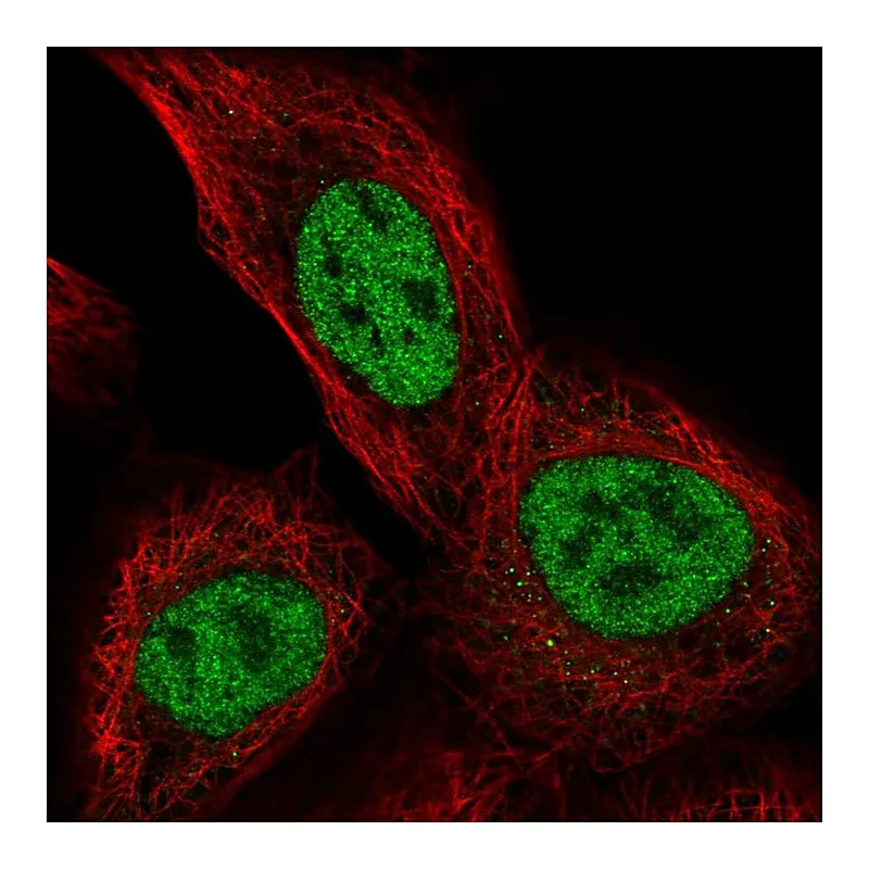 Atlas Antibodies Anti-TSSC4 Antibody