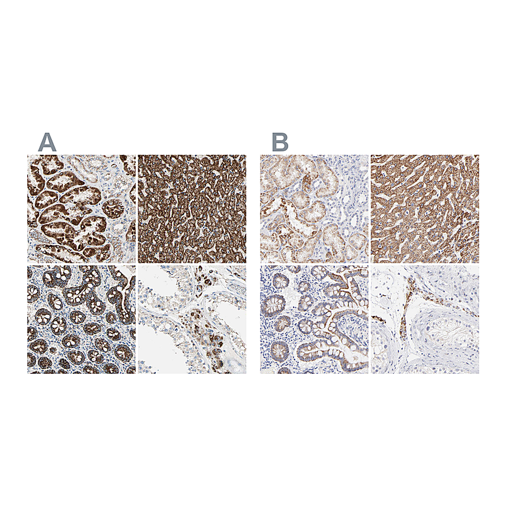 Atlas Antibodies Anti-TST Antibody