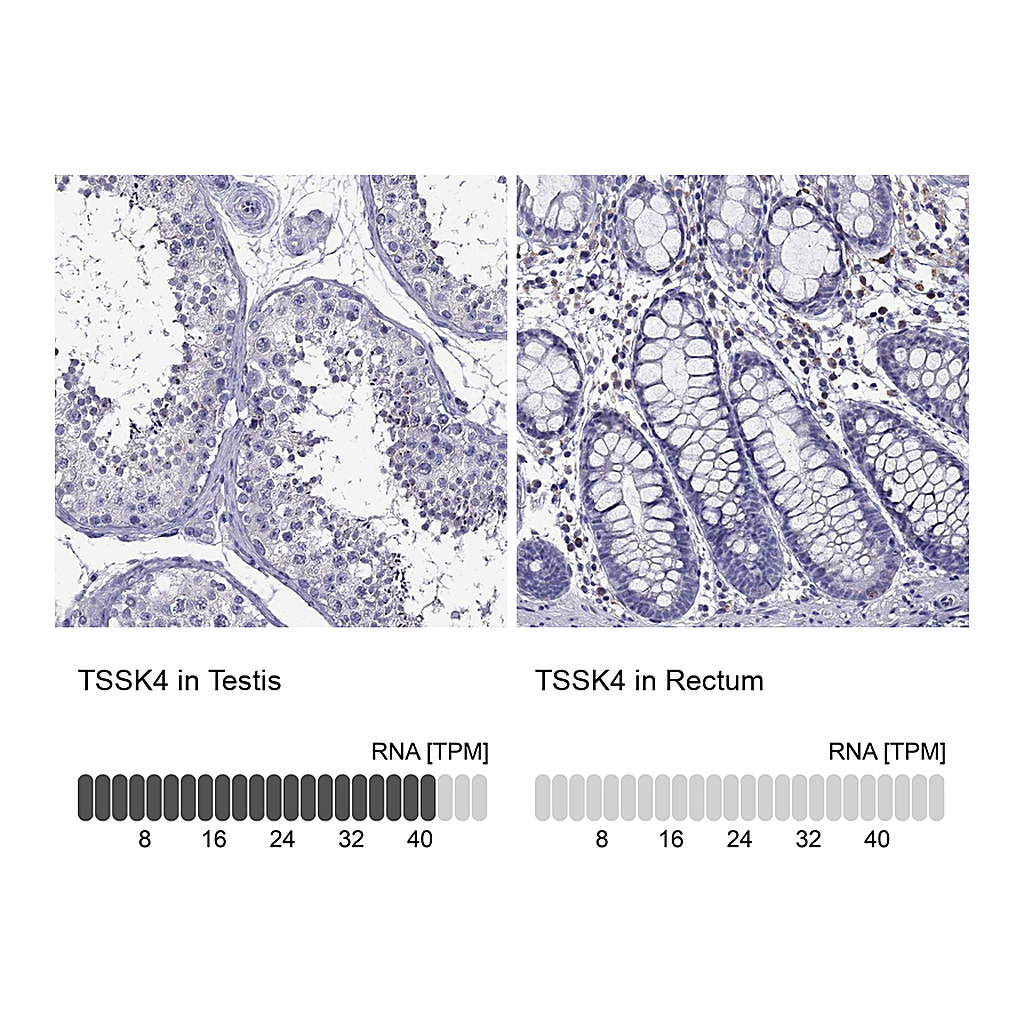 Atlas Antibodies Anti-TSSK4 Antibody