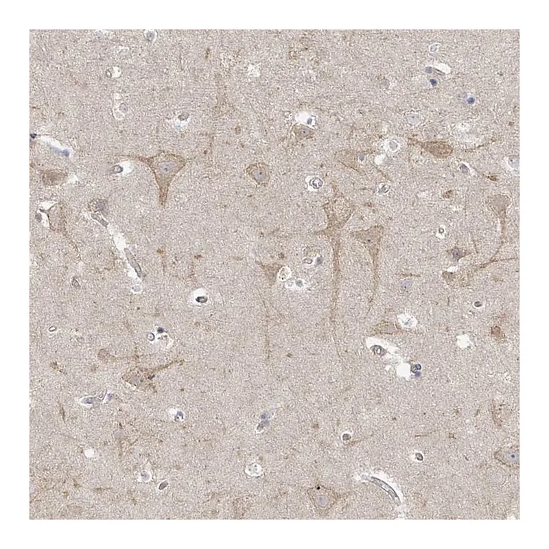 Atlas Antibodies Anti-TSSC1 Antibody