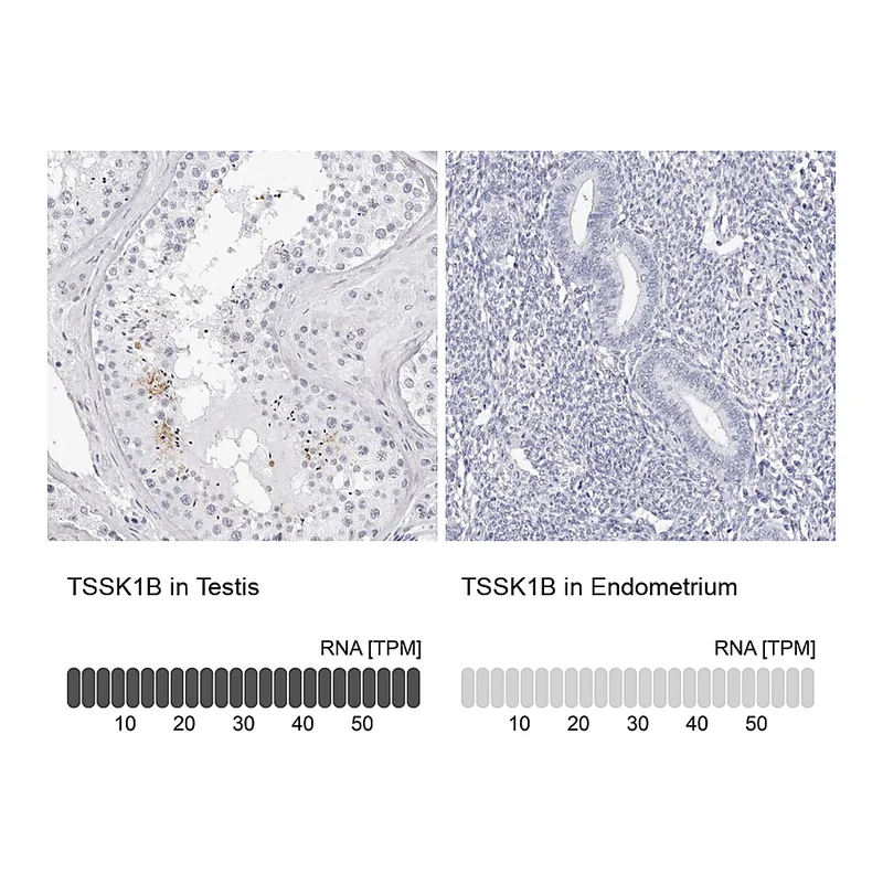 Atlas Antibodies Anti-TSSK1B Antibody
