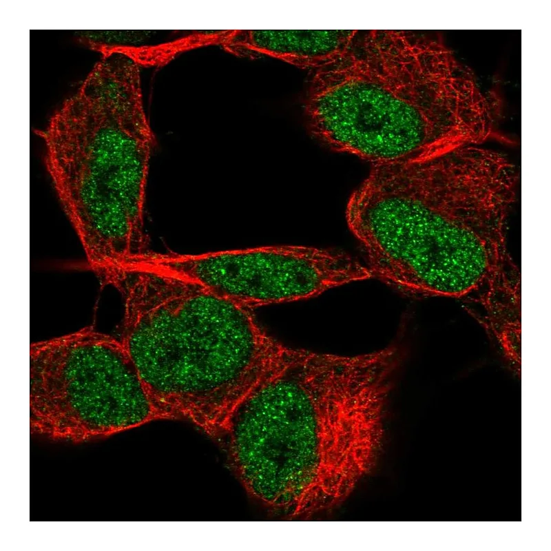 Atlas Antibodies Anti-TSTD2 Antibody