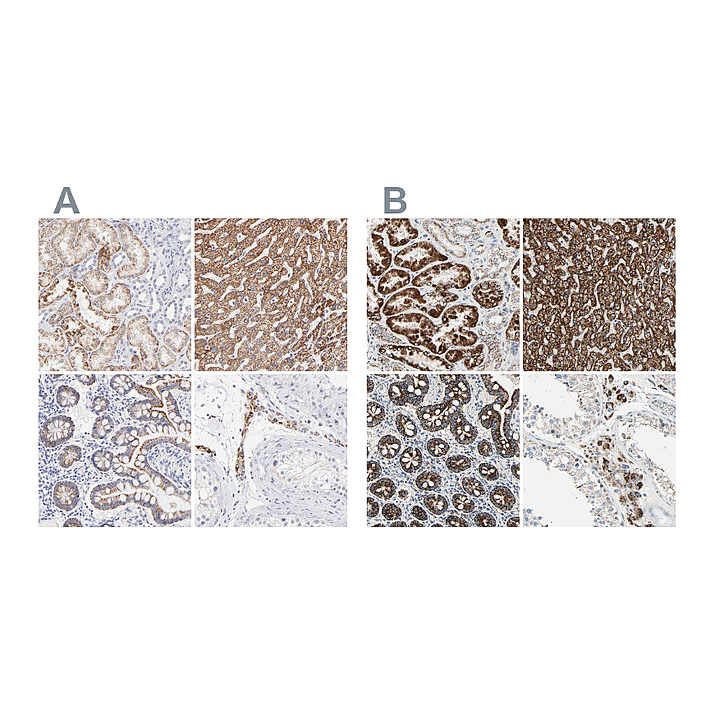 Atlas Antibodies Anti-TST Antibody